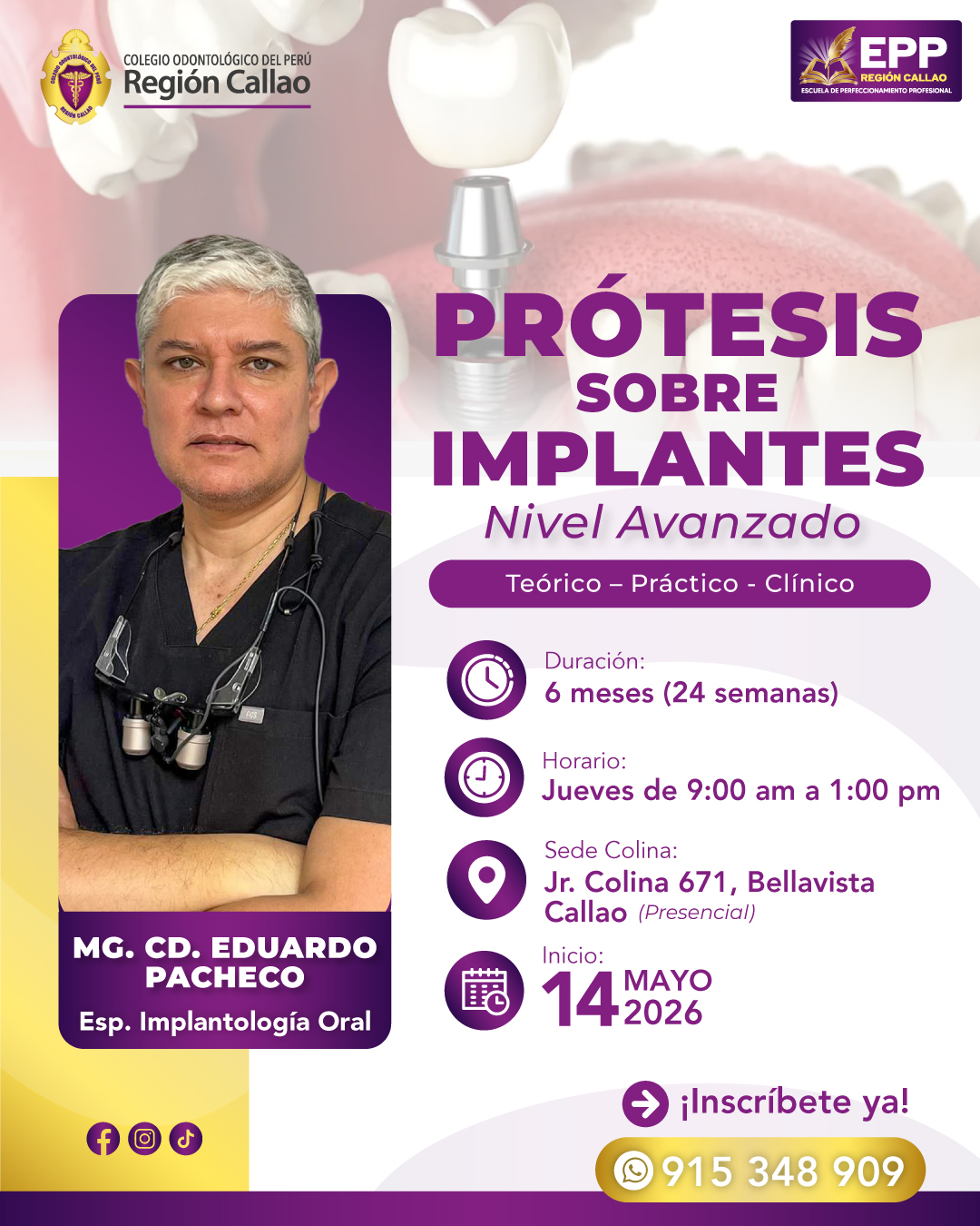Protesis-sobre-implants